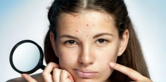 10 Best Dark Spot Correcting and Brightening Creams for Face best cream for dark spots on face
