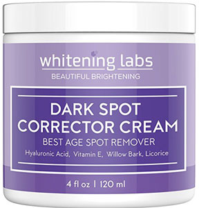 Best Over the Counter Cream for Dark Spots on Face